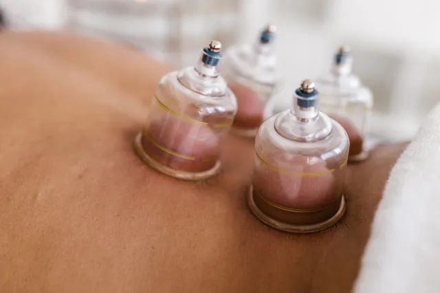 Cupping Massage – Traditional & Modern Techniques